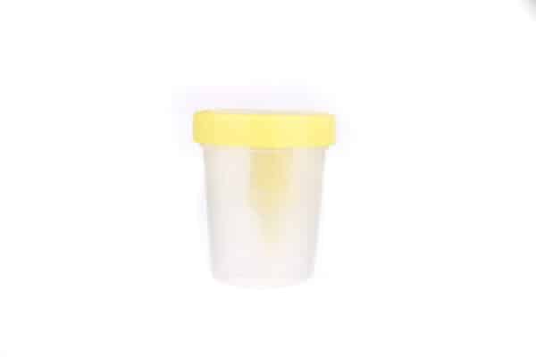 Urine Container with Needle